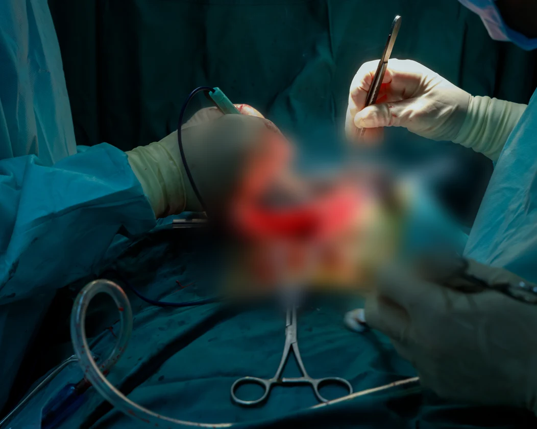 Poradnia chirurgii klatki piersiowej